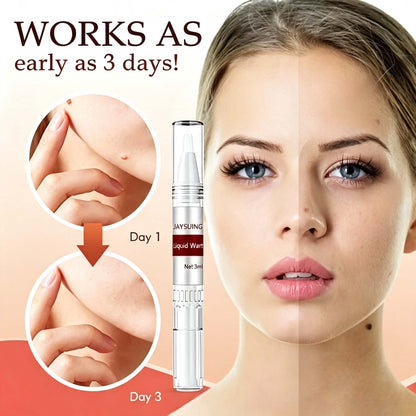 LAST DAY 50% OFF Tags & Moles Remover