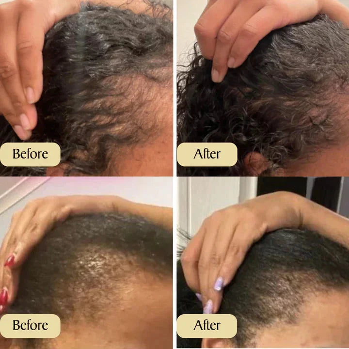 🔥Hot Sale 49% OFF--Natural Hair Growth Oil