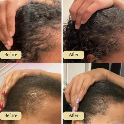 🔥Hot Sale 49% OFF--Natural Hair Growth Oil