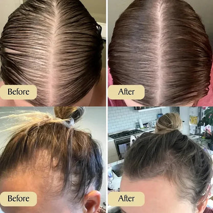 🔥Hot Sale 49% OFF--Natural Hair Growth Oil